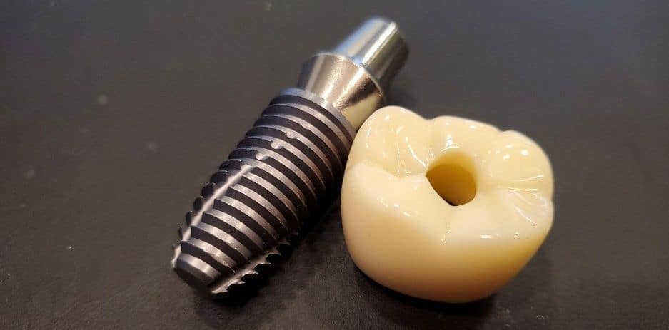 fog implantátum szemléltető eszköz