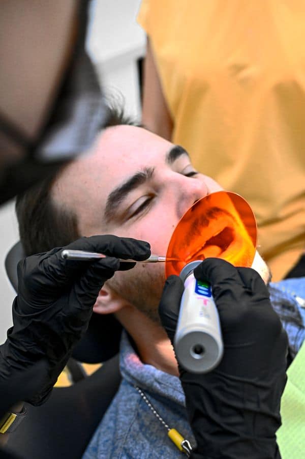 Fogtömés közben a Denteo fogászaton