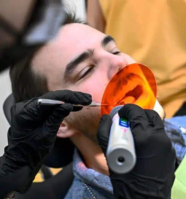 Fogtömés közben a Denteo fogászaton