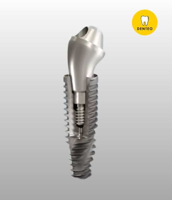 fog implantátum
